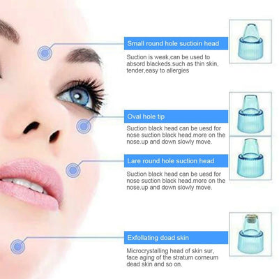 Cell Operated Blackhead Removal